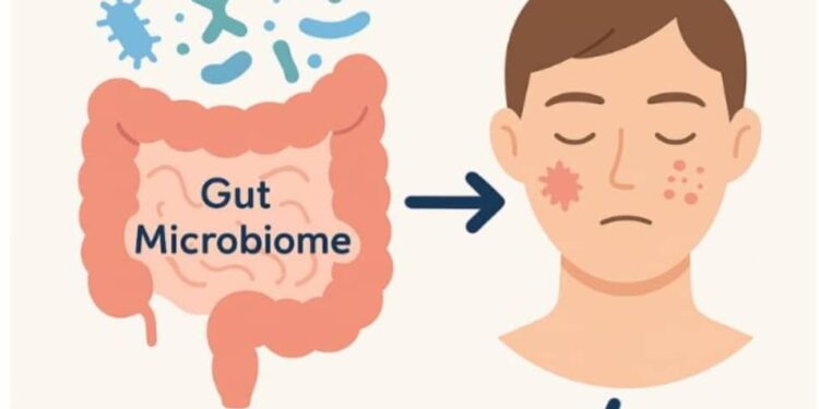 The Gut-Skin Connection: Why Probiotics Matter